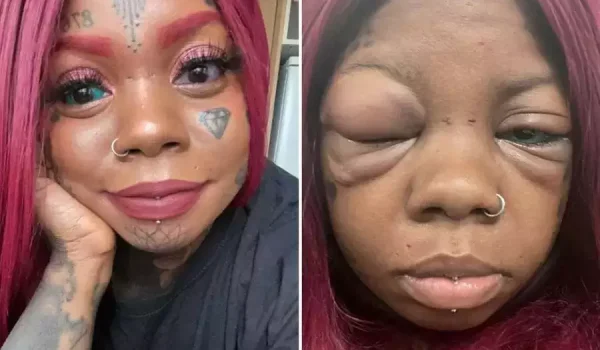 Woman Tattoos Her Eyeballs Blue and Purple and is Now Going Blind
